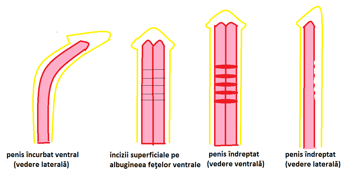 Care este mărimea medie a penisului? - bloglist.ro